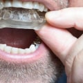 Do I Need a Special Mouthguard After Oral Surgery?