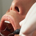 Is Oral Surgery Permanent? A Comprehensive Guide