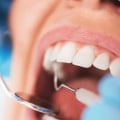 Is Oral Surgery Painful? Expert Advice on What to Expect