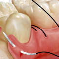 The Most Common Types of Oral Surgery Explained