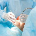 What is Oral Surgery and How Can It Help You?