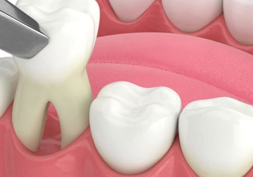 What to Do if You Experience Pain or Discomfort After Oral Surgery