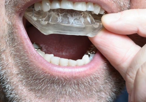Do I Need a Special Mouthguard After Oral Surgery?