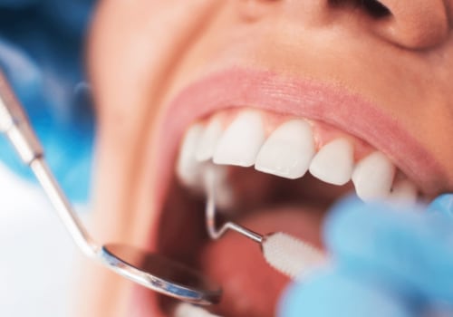 Potential Complications of Oral Surgery: What You Need to Know