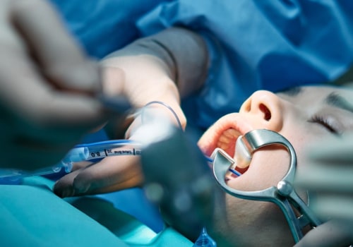 Understanding The Role Of Periodontics In Successful Oral Surgeries In San Antonio